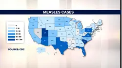 US breaks record for measles cases