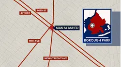 Man injured in Borough Park slashing